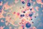 Misdiagnosis of Pancreatic Cancer Pittsburgh, PA