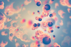 Misdiagnosis of Pancreatic Cancer Pittsburgh, PA
